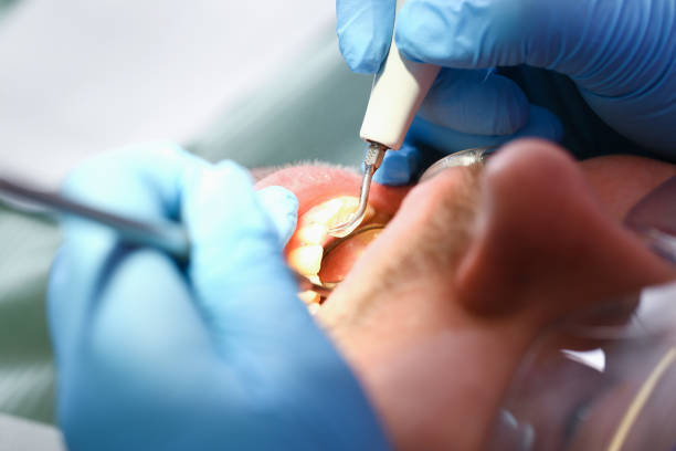 Best Pediatric Emergency Dentist in Parma, ID